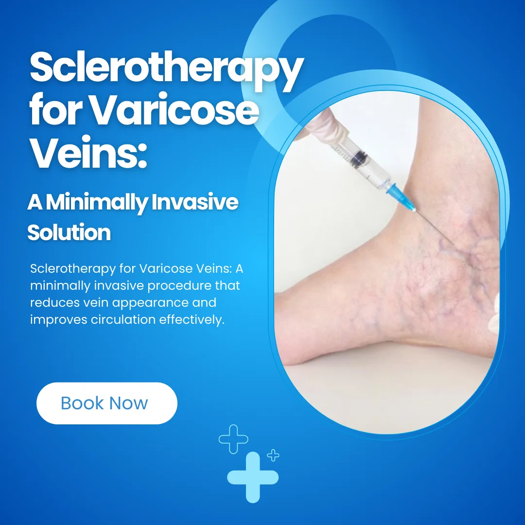 Sclerotherapy injection being given into a leg vein, on a Sclerotherapy for Varicose Veins banner