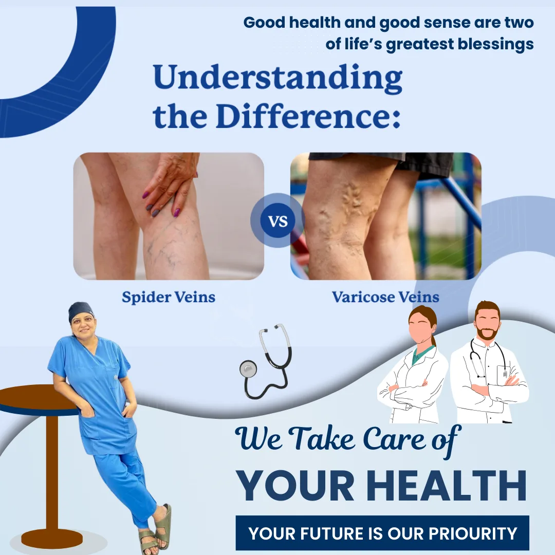 Side-by-side comparison of fine spider veins and raised, twisted varicose veins on the legs